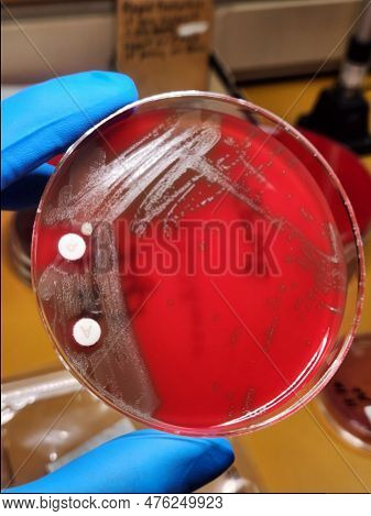 Streptococcus Pneumoniae On Blood Agar With Bacitracin And Optochin Discs