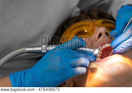 Female Dentist And Assistant Removing Dental Calculus From Teeth. Visit Is In Proffessional Dental C