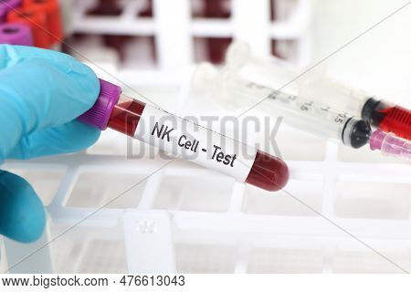 Nk Cell Test, Blood Sample To Analyze In The Laboratory, Blood In Test Tube