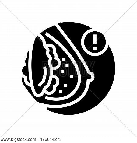 Capsular Contracture Surgery Glyph Icon Vector. Capsular Contracture Surgery Sign. Isolated Symbol I