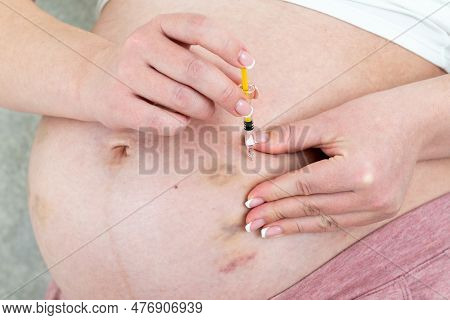Blood Thinners Concept. Close Up Of Pregnant Woman Making Injection In Stomach With Bruises