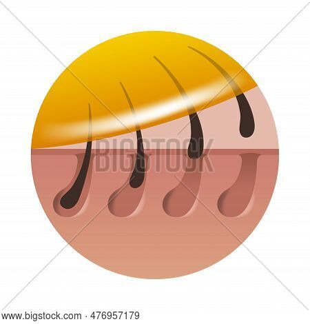 Wax Strips And Sugaring - Persian Sugar Waxing, Hair Removal Method Using Hot Wax. Vector Icon