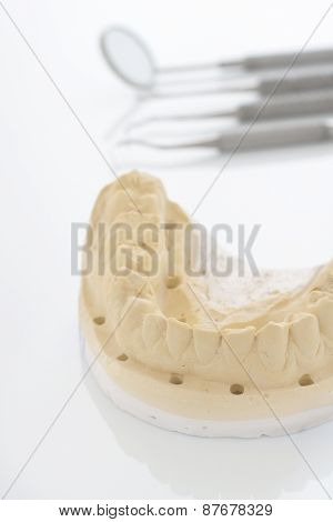 Orthodontic Cast