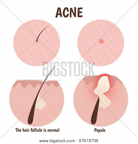 structure of the hair follicle