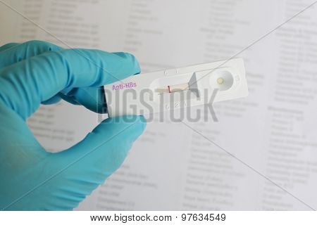 Anti-HBs negative