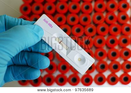 Anti-HBs negative