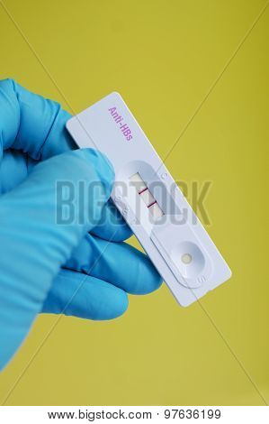 Anti-HBs positive