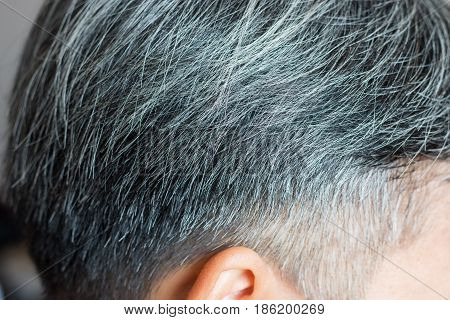 Going gray in young man shows his gray hair hair getting grey and balding
