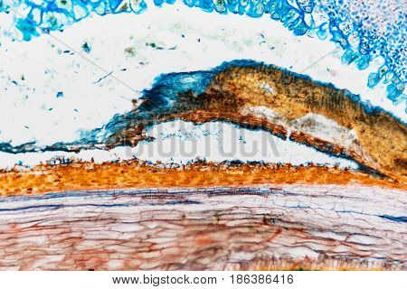 Cell Microscopic- Weevil Rye