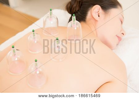 Cupping Cups On Back Of Asian Female