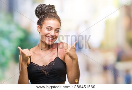 Young braided hair african american with pigmentation blemish birth mark over isolated background success sign doing positive gesture with hand, thumbs up smiling and happy. Looking at the camera