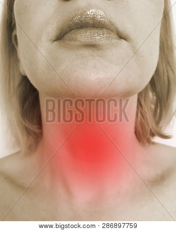 Woman Sore Throat Symptom Respiratory, Choke, Suffocation, Shock, Adenoids