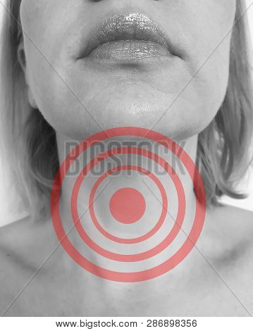 Woman Sore Throat Symptom Respiratory, Choke, Suffocation, Shock, Adenoids
