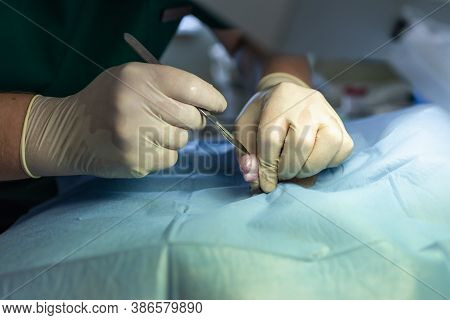 Close Up Sterilization Of Dog On Surgical Tables Under General Anesthesia And Veterinary Surgeons. V