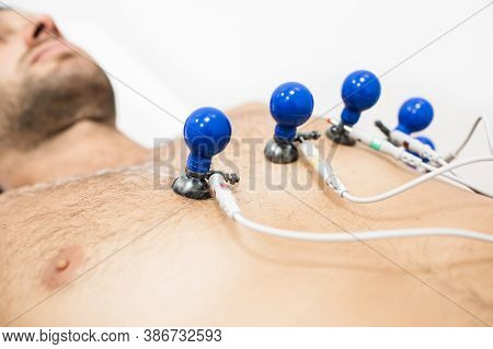 Patient Getting Heart Rate Monitored At Hospital. Close-up Of Ecg Electrodes, Soft Focus