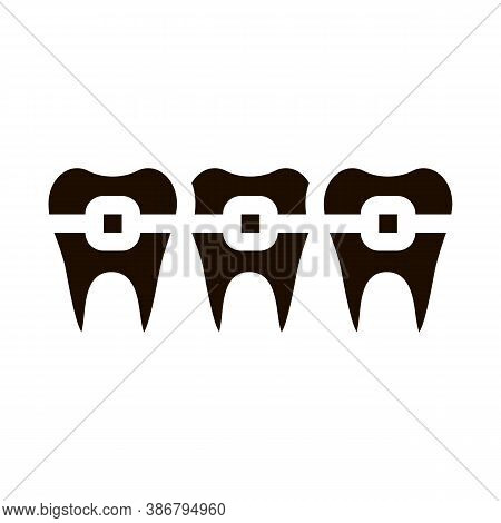 Dentist Stomatology Teeth Braces Vector Sign Icon . Teeth Braces Bracket, Orthodontic Appliance Pict