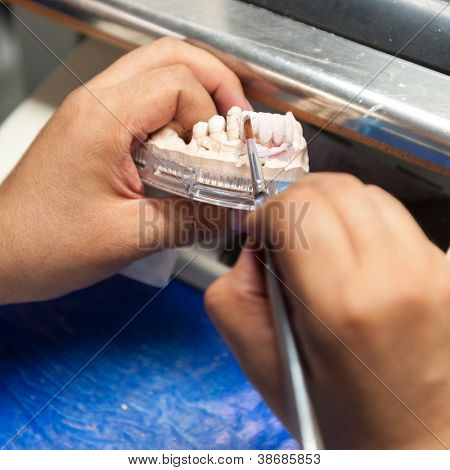 Prothetischen Dentallabor, technische Aufnahmen