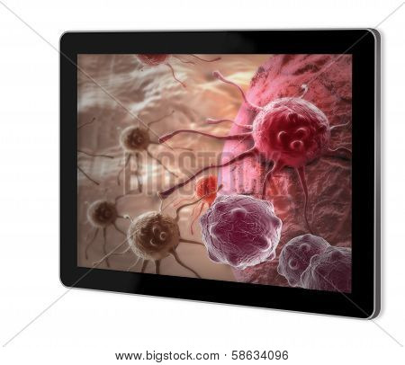 Cancer Cell