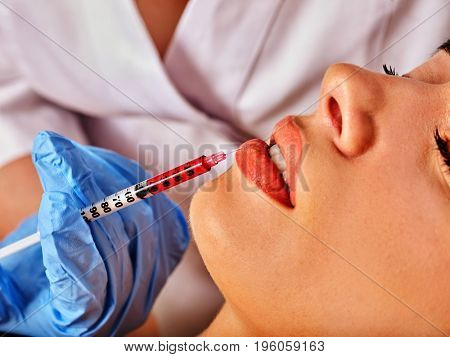 Filler injection for female forehead face. Plastic aesthetic facial surgery in beauty clinic. Silicone lips. Doctor in medical gloves with syringe injects lips augmentation. Preservation of youth.
