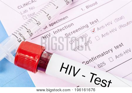 Sample blood collection tube with HIV test label on HIV infection screening test form.