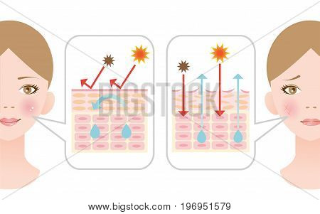 diagram of dry skin and healthy skin