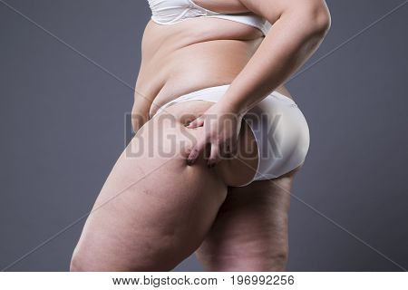 Overweight woman with fat legs obesity female body on gray background