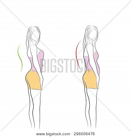 Correct Alignment Of Human Body In Standing Posture For Good Personality And Healthy Of Spine And Bo