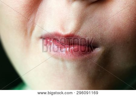 Mouth Of A 5 Years Old Boy. Closeup