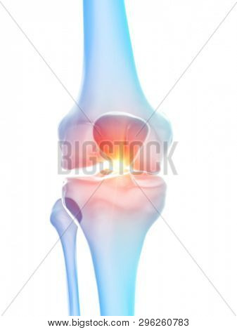 3d rendered medically accurate illustration of the knee joint showing pain