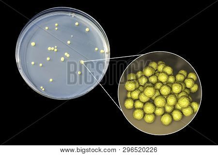 Colonies Of Micrococcus Luteus Bacteria On Agar Plate And Close Up View Of Micrococci Bacteria, Phot