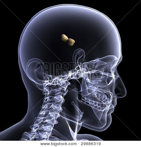 Radiografia scheletro-cervello arachide