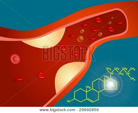 Cholesterol