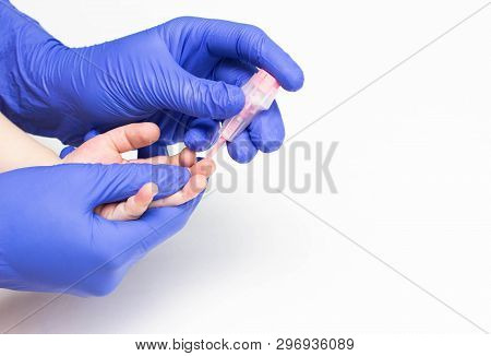The Doctor Takes Blood From A Finger. A Common Blood Test With A Scarifier In A Child For Erythrocyt
