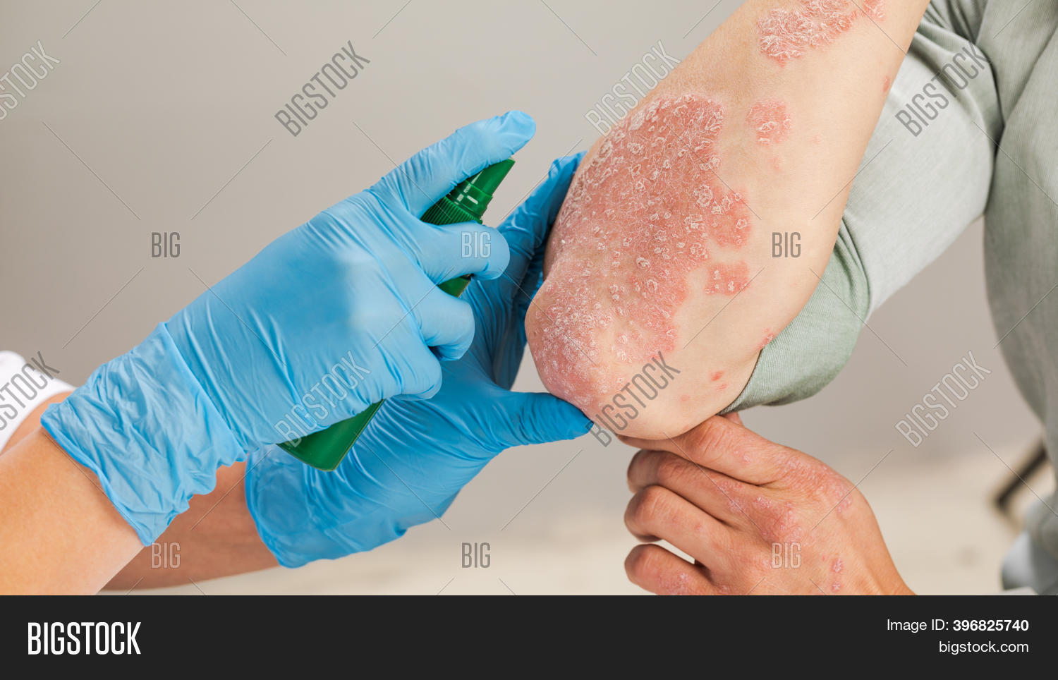 Dermatologist Wearing Image & Photo (Free Trial) Bigstock