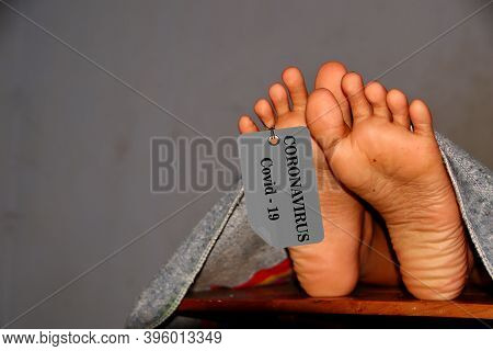 Not Focus And Noise Image, Concept Imitation Morgue, Coronavirus Victim Killed By 2019-ncov, Legs Of