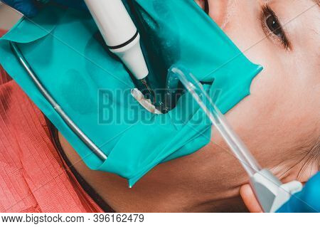 Treatment Of Posterior Tooth, Mouth Covered With Rubber Dam, Sterile Treatment With Modern Technolog