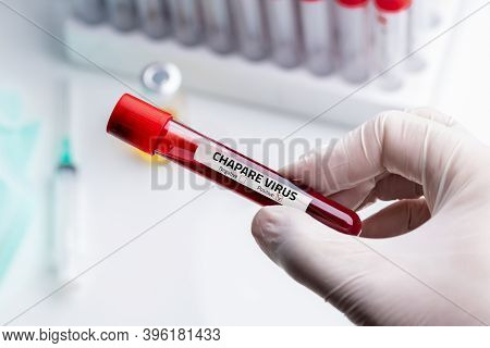 Nurse Wearing Respiratory Mask Holding A Positive Blood Test Result For Chapare Mammarenavirus