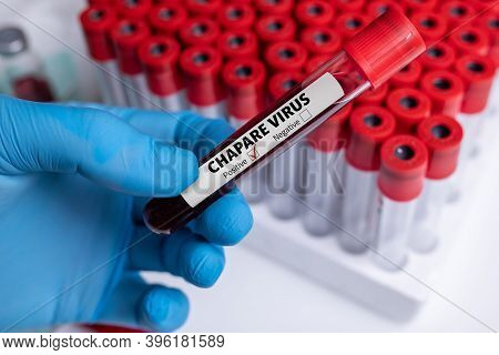 Nurse Wearing Respiratory Mask Holding A Positive Blood Test Result For Chapare Mammarenavirus