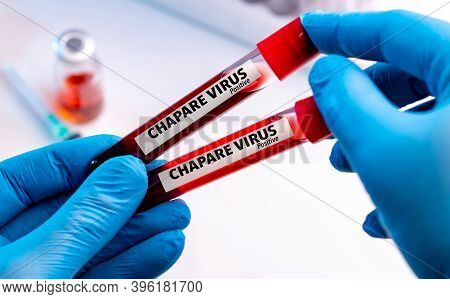 Nurse Wearing Respiratory Mask Holding A Positive Blood Test Result For Chapare Mammarenavirus