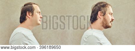 Portrait Of A Man 35-40 Years Old With A Beard And Without A Beard, Face In Profile. Adult Man Befor