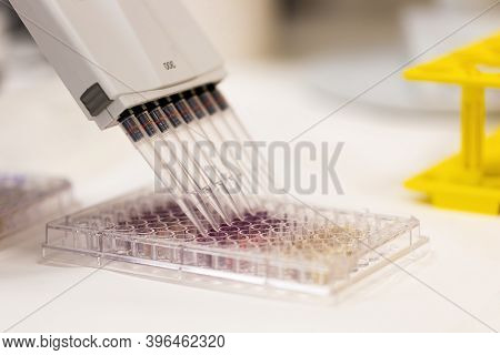 Medical Research With Multi Channel Pipette In Hospital