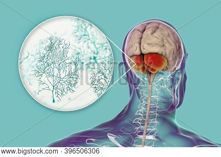 Human Brain With Highlighted Cerebellum And Close-up View Of Purkinje Neurons, One Of The Commonest 