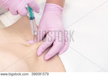 Lipolytic Injections Are Placed In The Stomach. Female Hands In Pink Gloves Inject A Young Woman Int