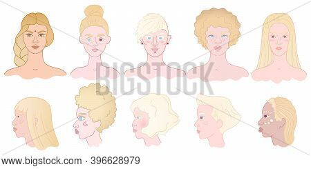 Hand Drawn Set Of Albino Women Portraits - Front And Side View. Diversity Young Girls With Albinism.