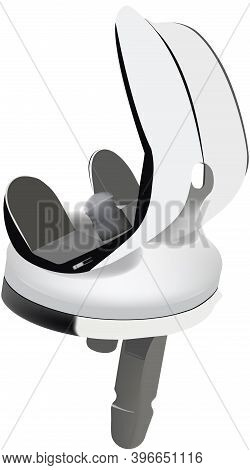 Knee Endoprosthesis Prosthesis Limb Surgery Knee Endoprosthesis Prosthesis Limb Surgery