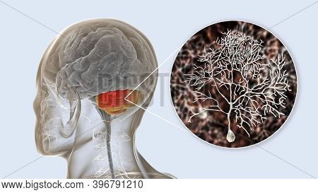 Human Brain With Highlighted Cerebellum And Close-up View Of Purkinje Neurons, One Of The Commonest 