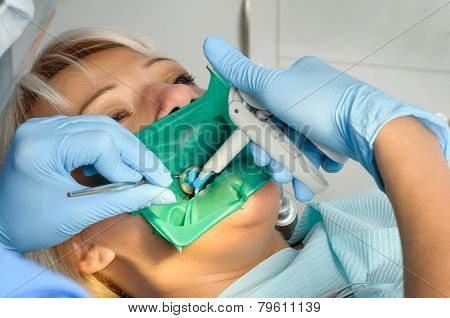 dentist with patient, cleaning and curing
