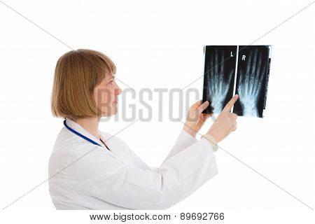 Young Female Doctor With X-ray Photograph