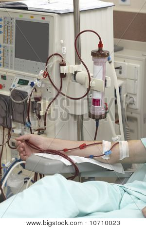 Dialyse Health Care Geneeskunde nier