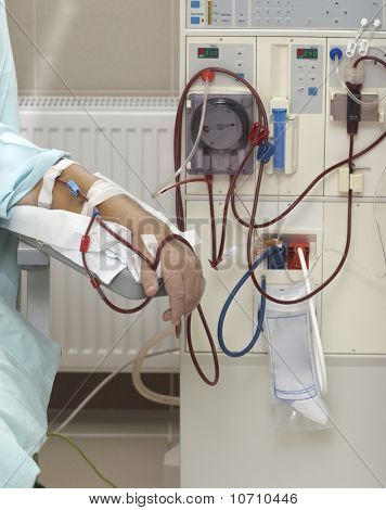 Dialyse Health Care Geneeskunde nier
